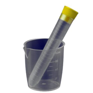 Kit p/ coleta de urina não estéril (1 frasco de coleta + 1 tubo 12mL em PP + 1 tampa de pressão interna amarela) 900und/cx Cralplast